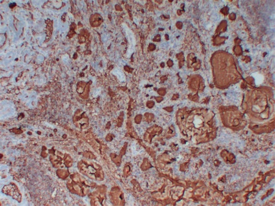 Thyroglobulin (PT2174) mouse mAb