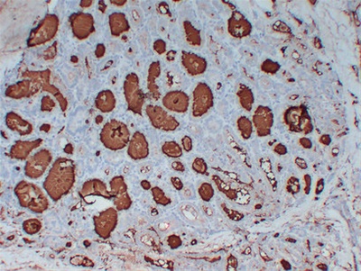 Thyroglobulin (PT2174) mouse mAb