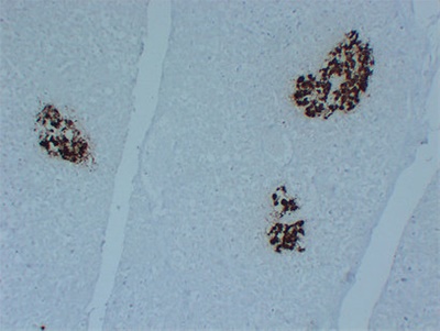 Insulin (PT2015) mouse mAb