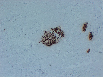 Insulin (PT2015) mouse mAb