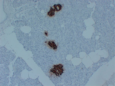 Insulin (PT2015) mouse mAb