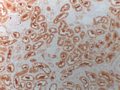 HDAC6 (ABT-HDAC6) mouse mAb