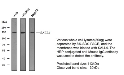 SALL4(PT2242) mouse mAb