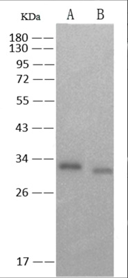 SARS-CoV-2 Spike Neutralizing Antibody, Rabbit Mab