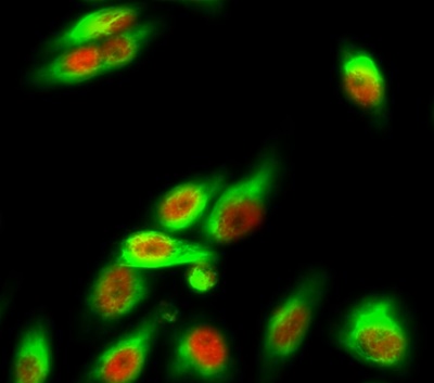 Phospho NFκB/p-NFκB p65 (Ser536) Polyclonal Antibody