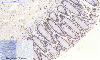 Phospho NFκB/p-NFκB p65 (Ser536) Polyclonal Antibody