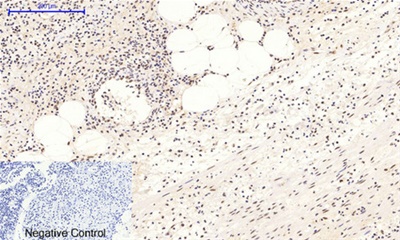 Phospho NFκB/p-NFκB p65 (Ser536) Polyclonal Antibody