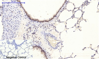 Phospho NFκB/p-NFκB p65 (Ser536) Polyclonal Antibody