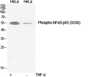 Phospho NFκB/p-NFκB p65 (Ser536) Polyclonal Antibody