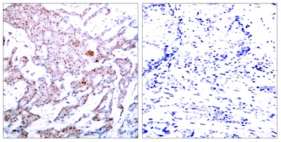 Phospho NFκB/p-NFκB p65 (Ser536) Polyclonal Antibody