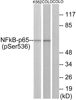 Phospho NFκB/p-NFκB p65 (Ser536) Polyclonal Antibody