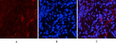 Phospho NFκB/p-NFκB p65 (Ser536) Polyclonal Antibody