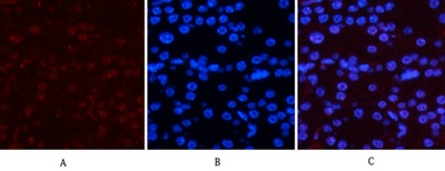 Phospho NFκB/p-NFκB p65 (Ser536) Polyclonal Antibody