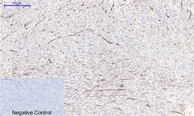 Phospho NFκB/p-NFκB p65 (Ser536) Polyclonal Antibody