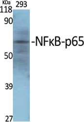 NFκB p65 Polyclonal Antibody