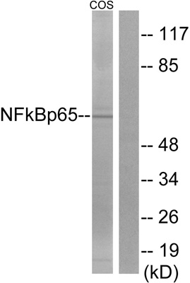 NFκB p65 Polyclonal Antibody