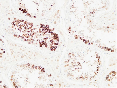 Histone H3 Polyclonal Antibody