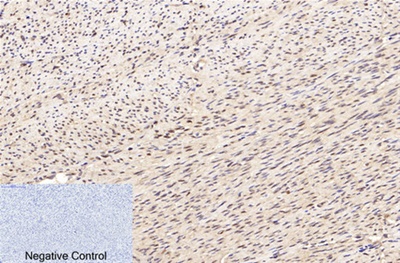 Lamin B1 Monoclonal Antibody(7C11)