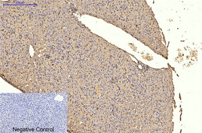α-SMA Monoclonal Antibody(6A12)