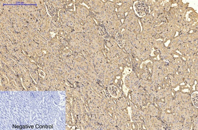 α-SMA Monoclonal Antibody(6A12)