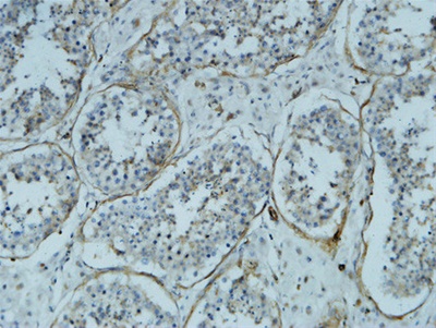 α-SMA Monoclonal Antibody(6A12)