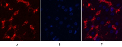 α-SMA Monoclonal Antibody(6A12)