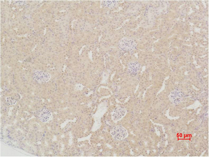 SOD2 Polyclonal Antibody