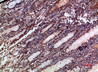 Mox1 Polyclonal Antibody