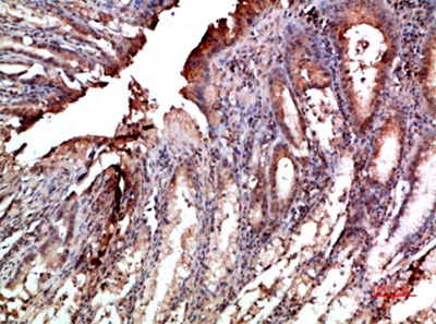 Mox1 Polyclonal Antibody