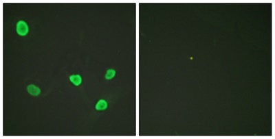 Histone H2B Polyclonal Antibody
