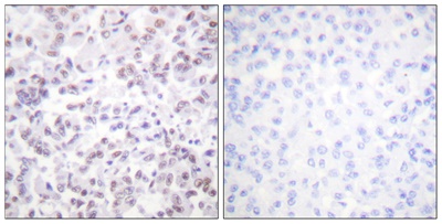 Histone H2B Polyclonal Antibody