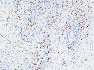 IL-6Rα Polyclonal Antibody