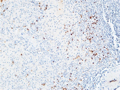 IL-6Rα Polyclonal Antibody