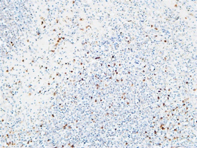 IL-6Rα Polyclonal Antibody
