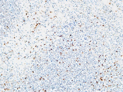 IL-6Rα Polyclonal Antibody