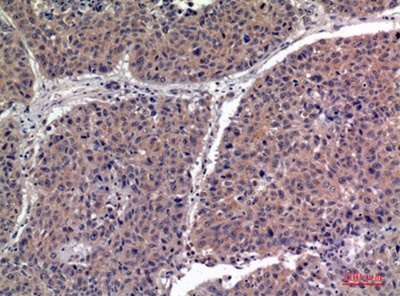 IGFBP1 Polyclonal Antibody