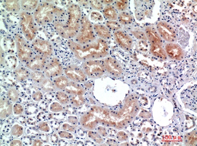 CD26 Polyclonal Antibody