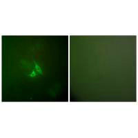 COX2/PTGS2 Polyclonal Antibody