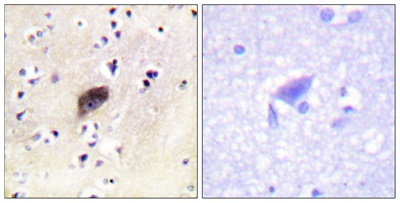 PAKα/β/γ (phospho Ser144/141/139) Polyclonal Antibody