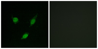 TACC1 Polyclonal Antibody