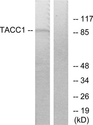 TACC1 Polyclonal Antibody