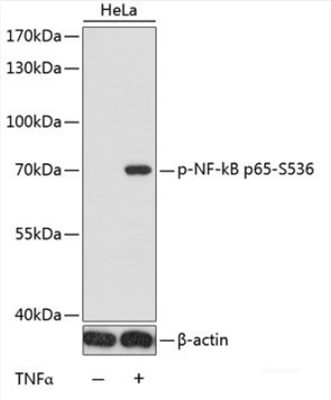 Phospho NFκB/p-NFκB p65 (Ser536) Polyclonal Antibody