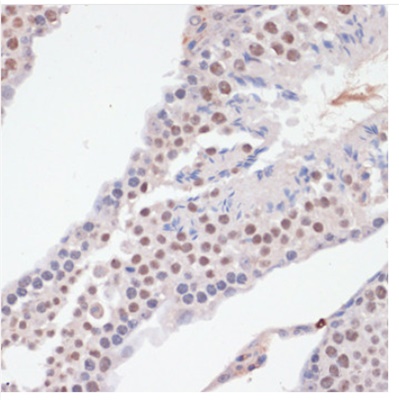 Phospho NFκB/p-NFκB p65 (Ser536) Polyclonal Antibody