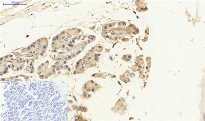 NFκB p65 Polyclonal Antibody
