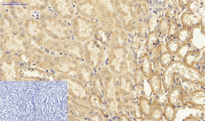 NFκB p65 Polyclonal Antibody