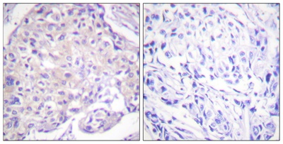Phospho-PAK1 (Thr212) Polyclonal Antibody