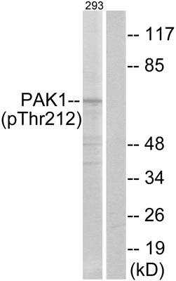 Phospho-PAK1 (Thr212) Polyclonal Antibody