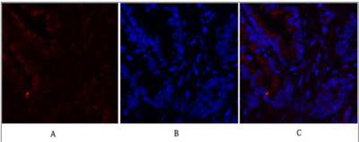 c-Fos Polyclonal Antibody