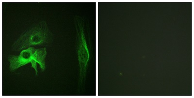PAK1 Polyclonal Antibody
