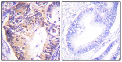 PAK1 Polyclonal Antibody